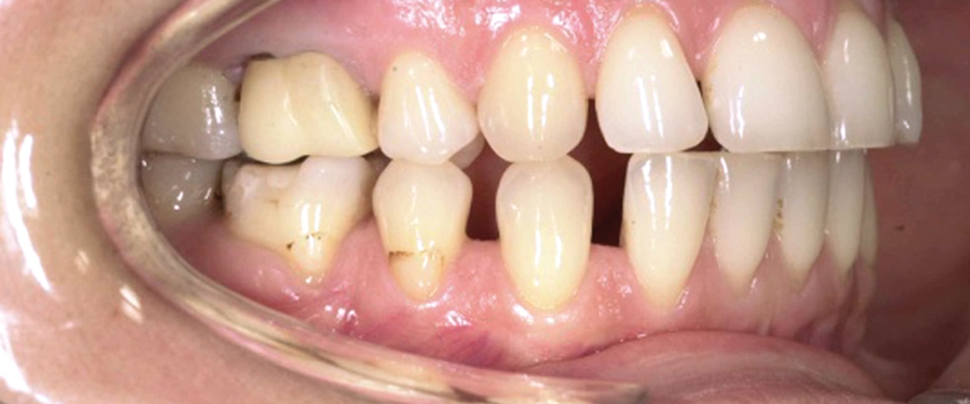 Iter Giuridico per il Risarcimento di Danni da Cure Dentistiche