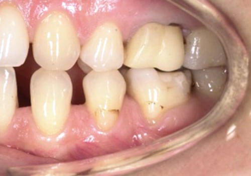 Iter Giuridico per il Risarcimento di Danni da Cure Dentistiche